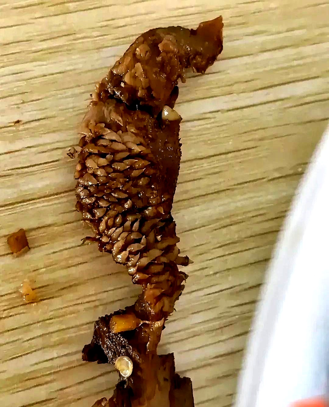 山东,一个女的下馆子吃饭,正吃着,突然发现盘子里