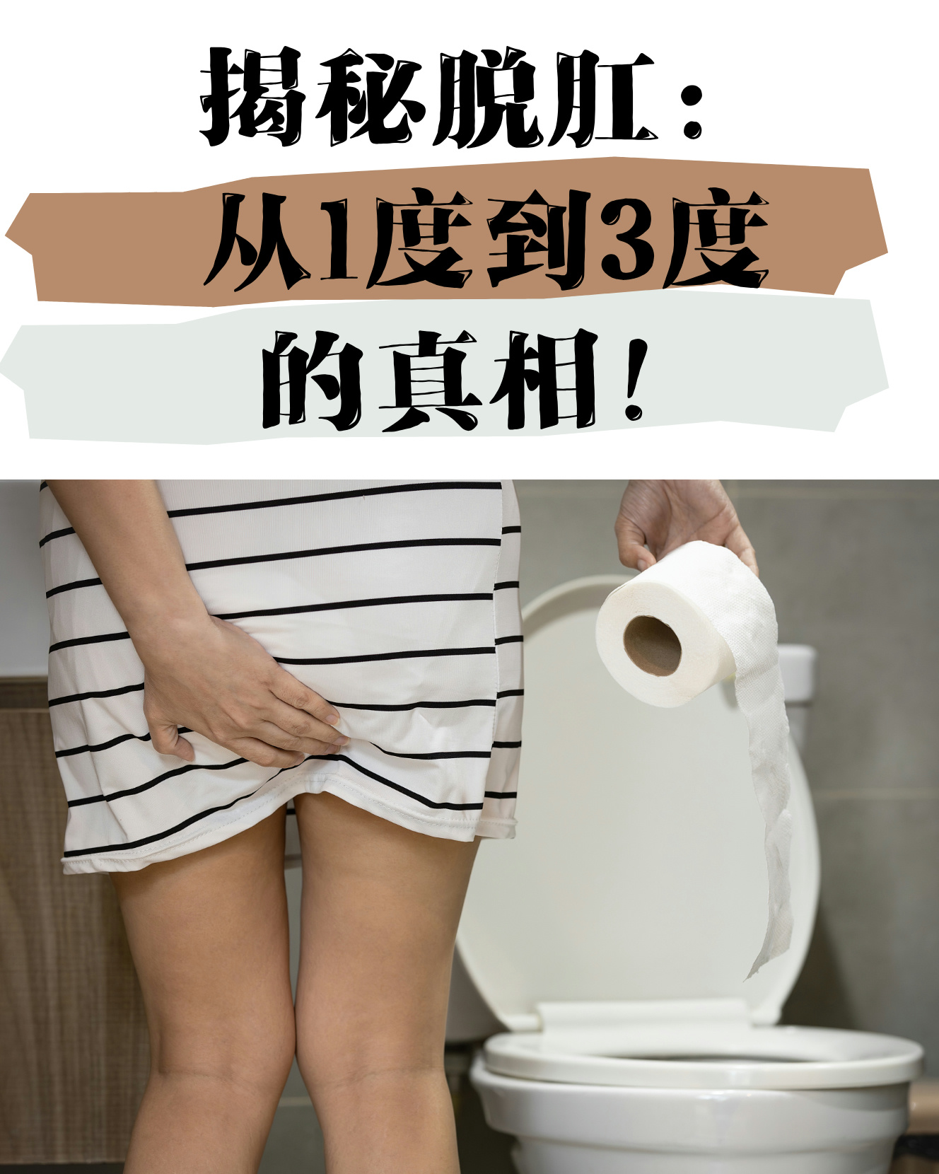 脱肛,也就是直肠脱垂,是指直肠的一部分从肛门向外突出