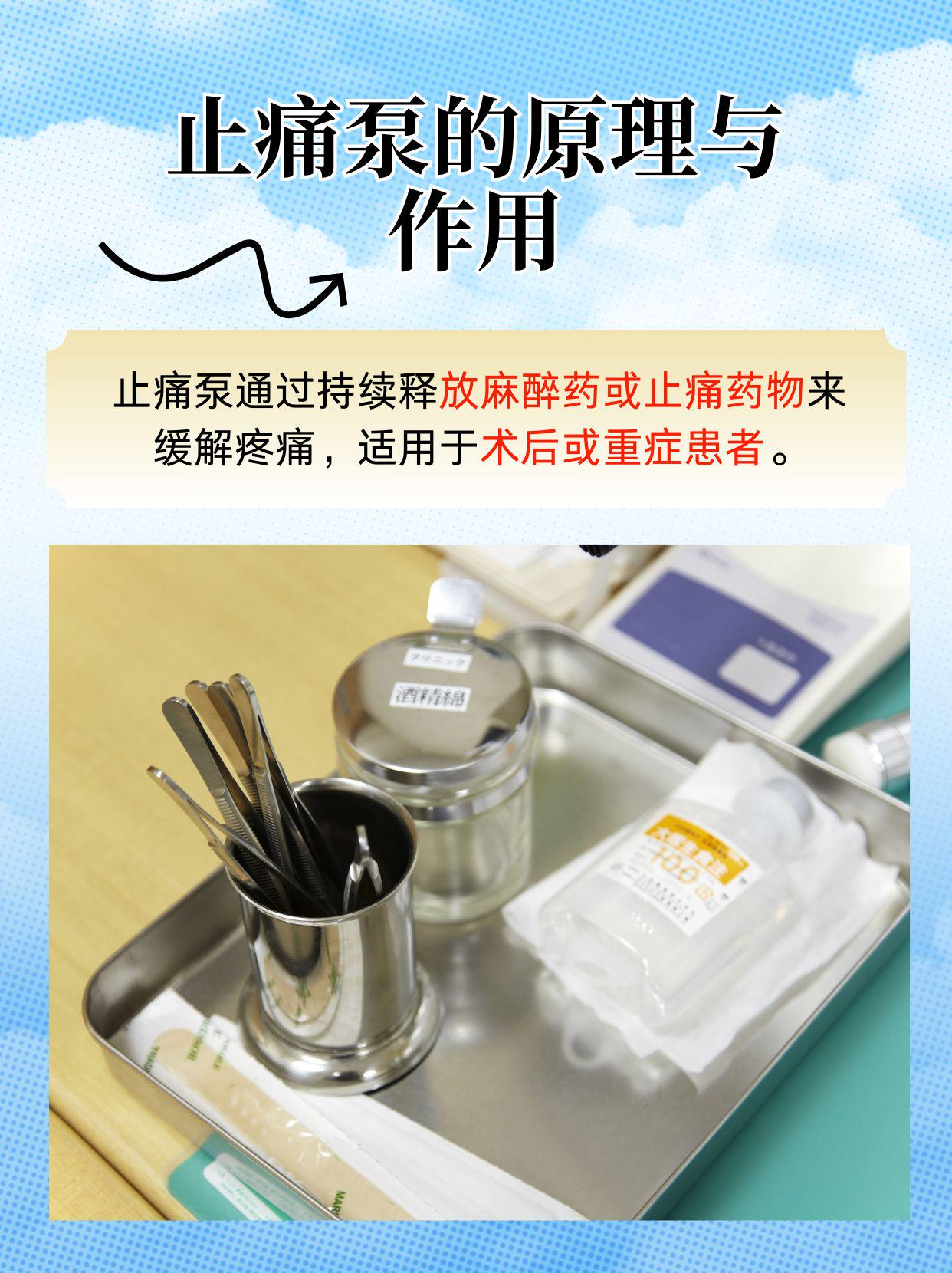 解答常见疑问 在术后或重大疾病治疗中,许多患者会使用止痛泵来缓解
