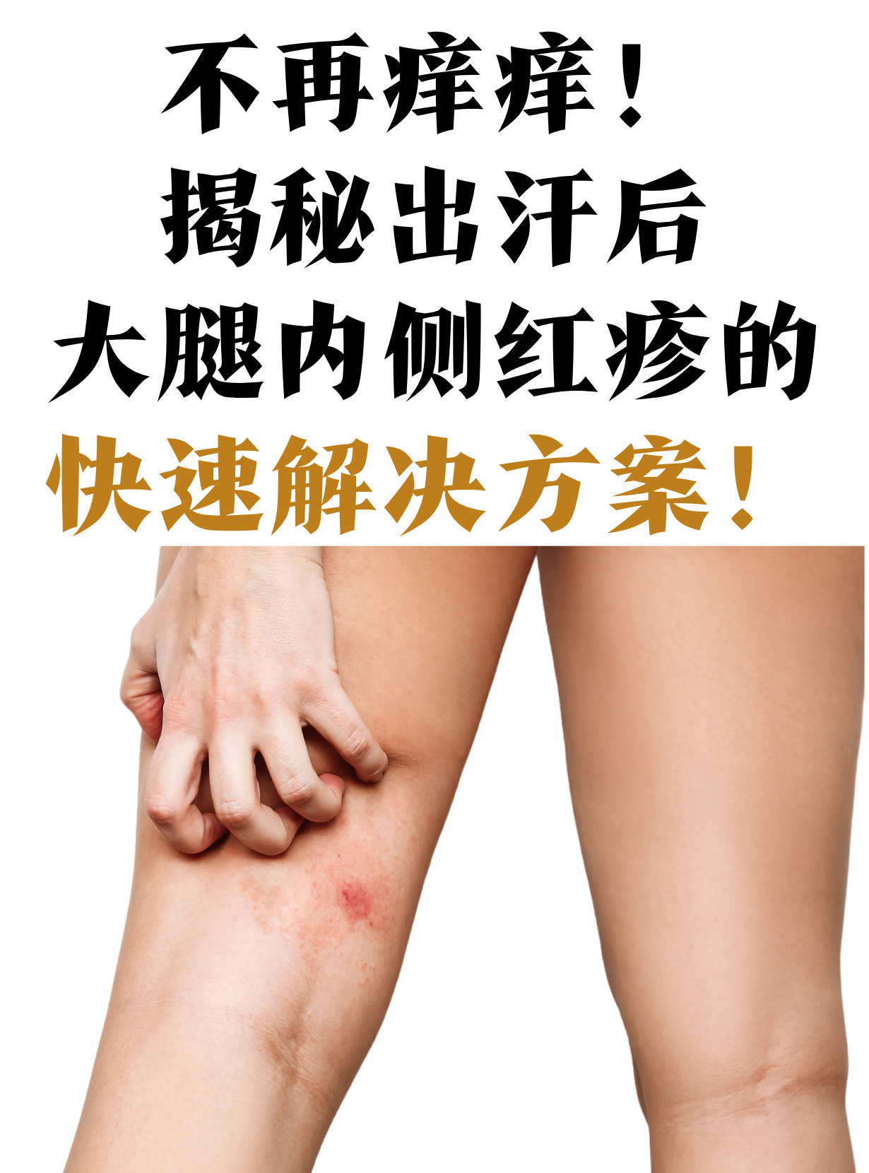 它们可能是痘痘闭口粉刺或者是