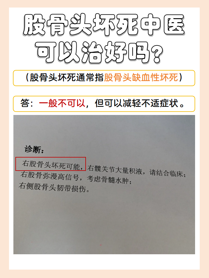 股骨头坏死中医可以治好吗?