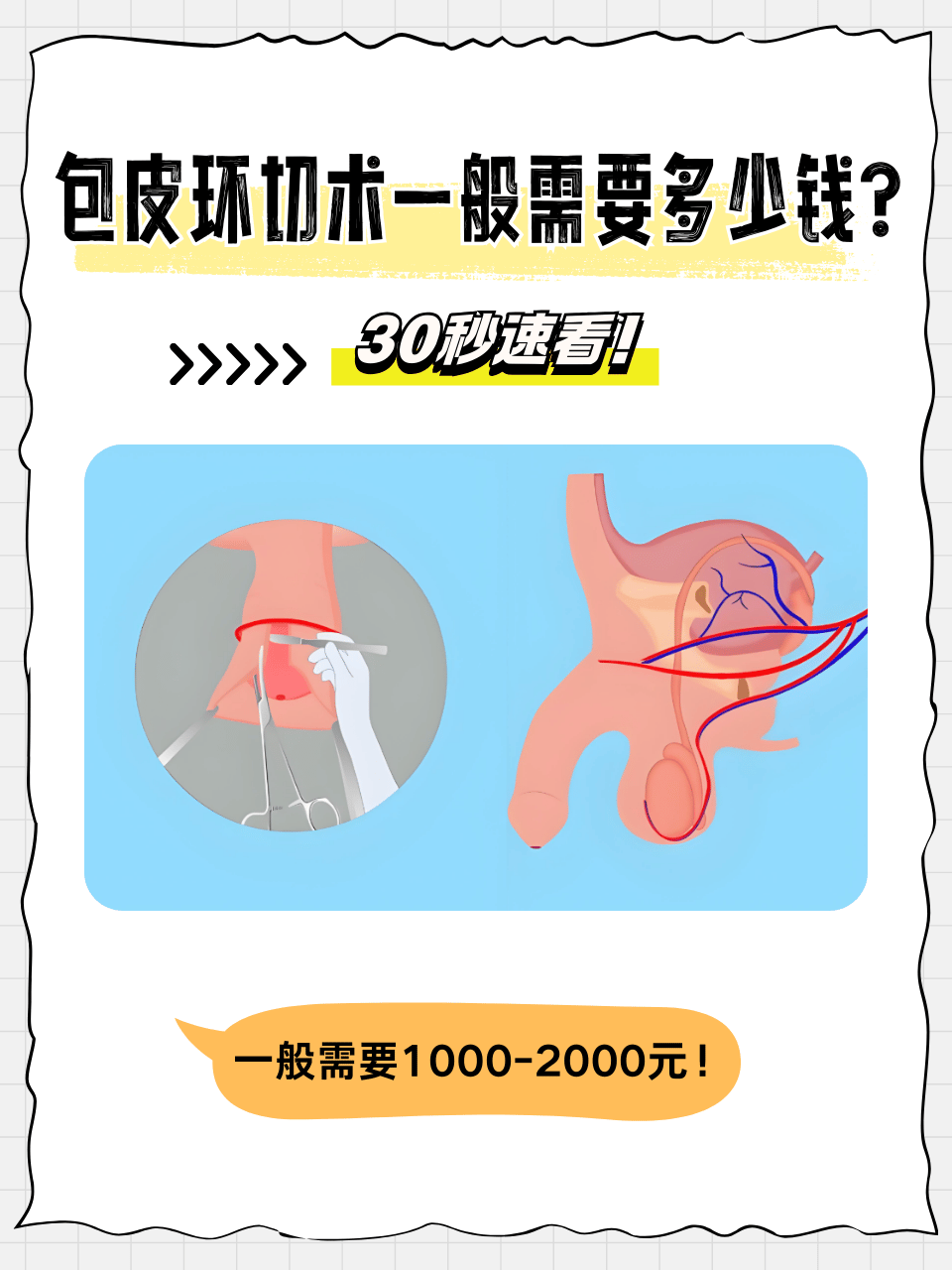 包皮环切术野 手术割包皮自翻和割包有区别图片包皮过长图片割了