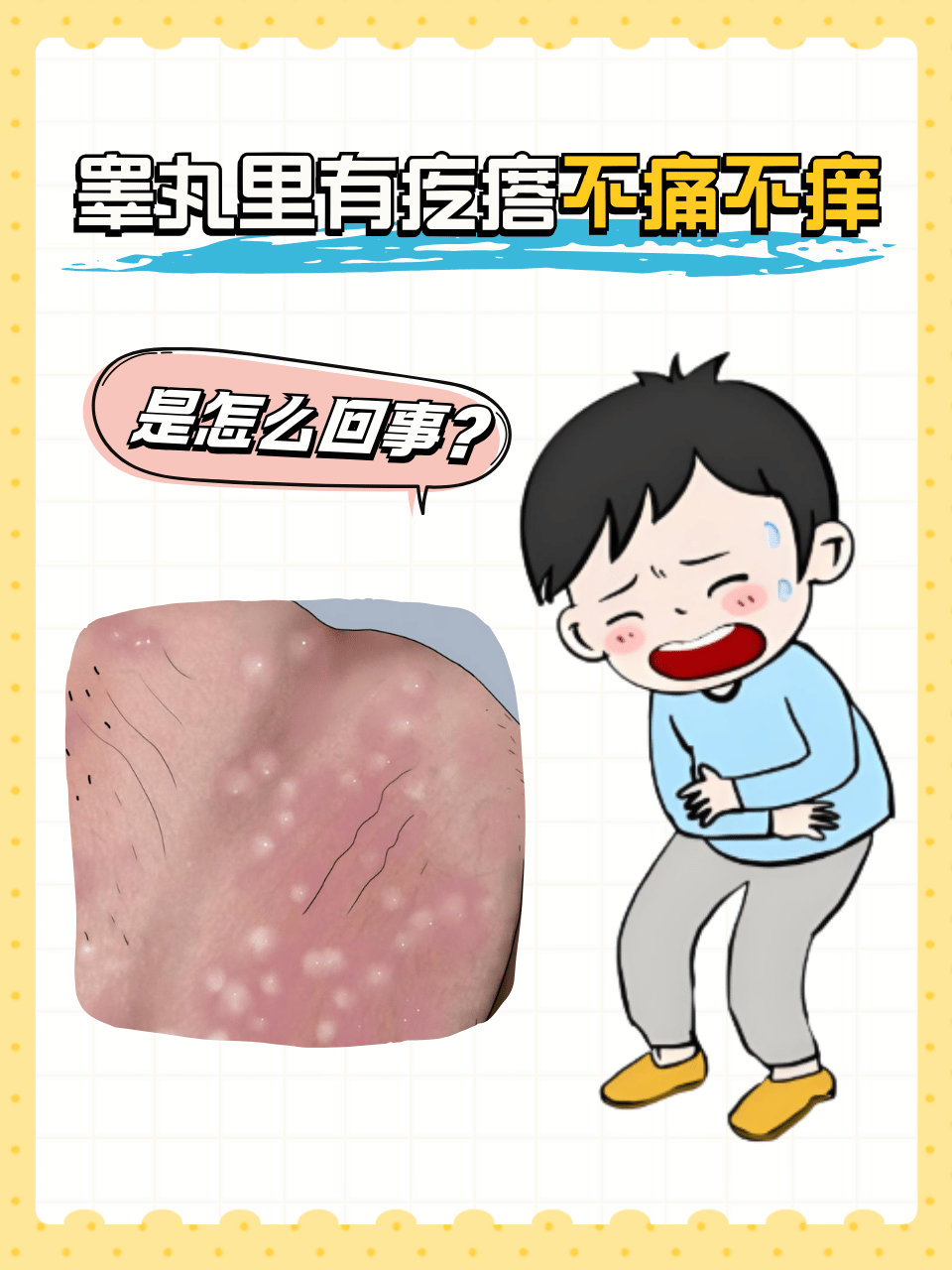 睾丸里有疙瘩不痛不痒,可能是这些问题引起的:  阴囊上长了小疙瘩是