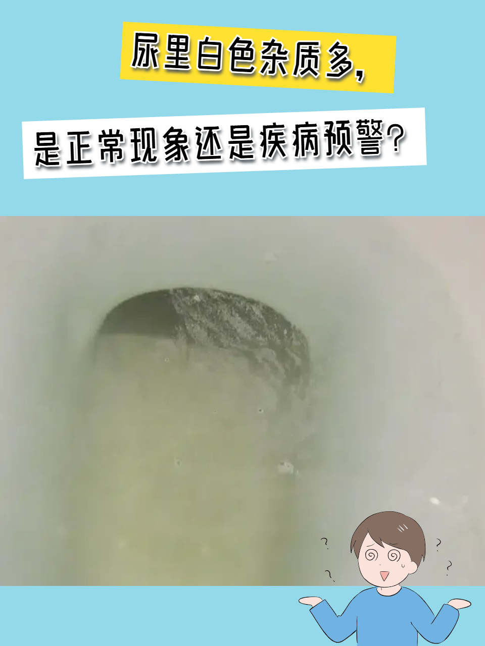 尿里白色杂质多,是正常现象还是疾病预警?