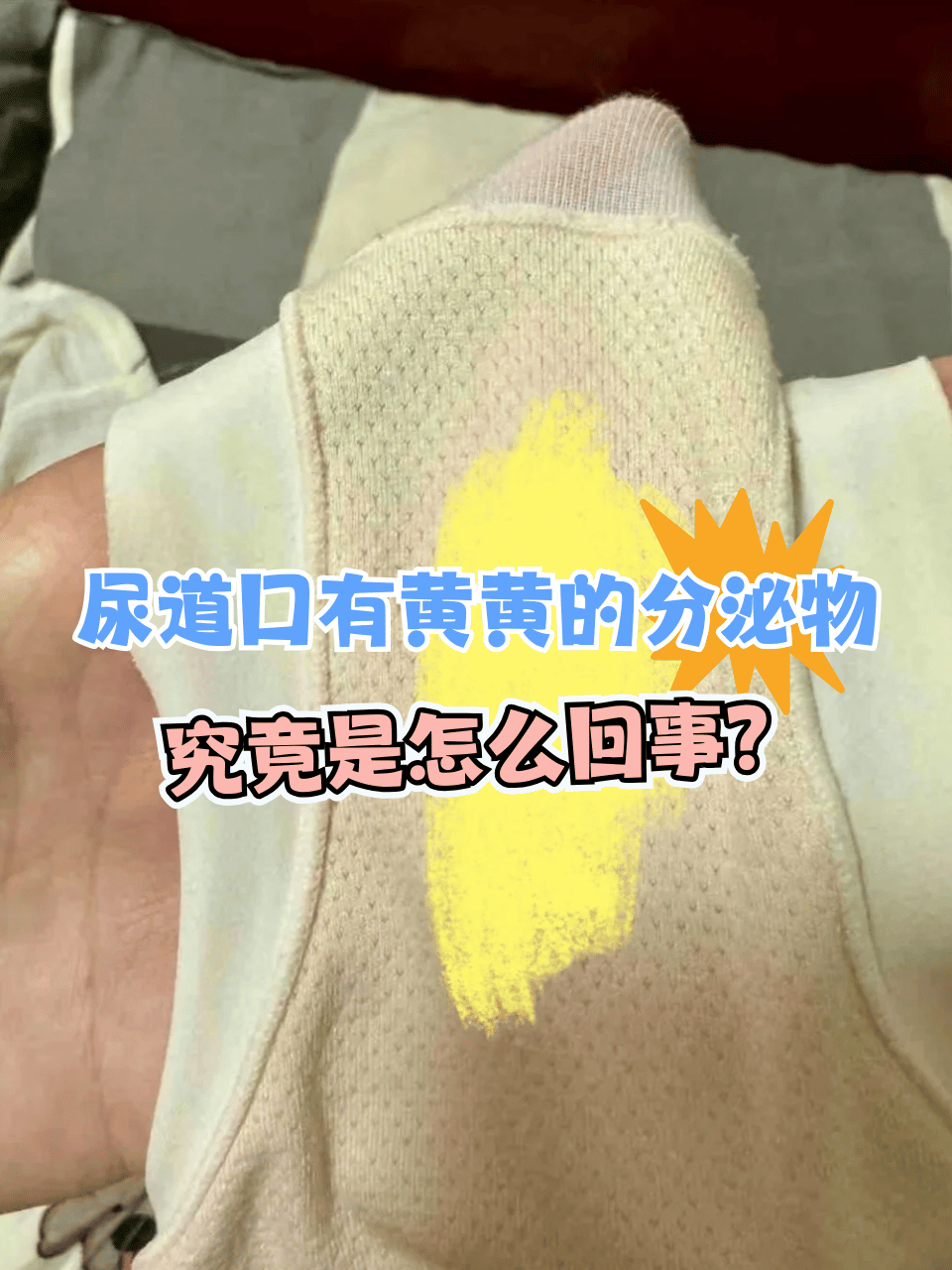 尿很黄很浓怎么回事百科在线