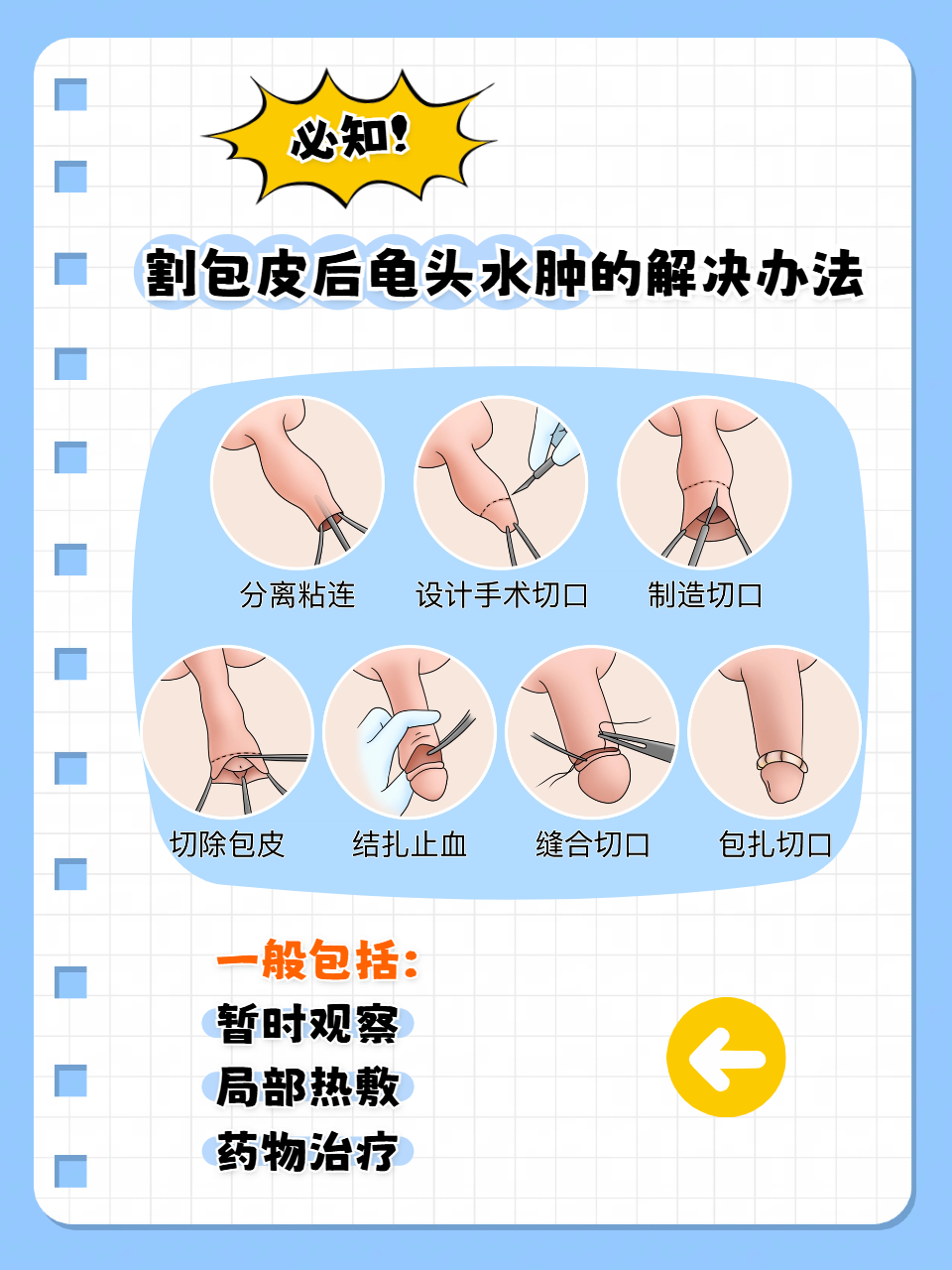 割包皮后龟头水肿的解决办法