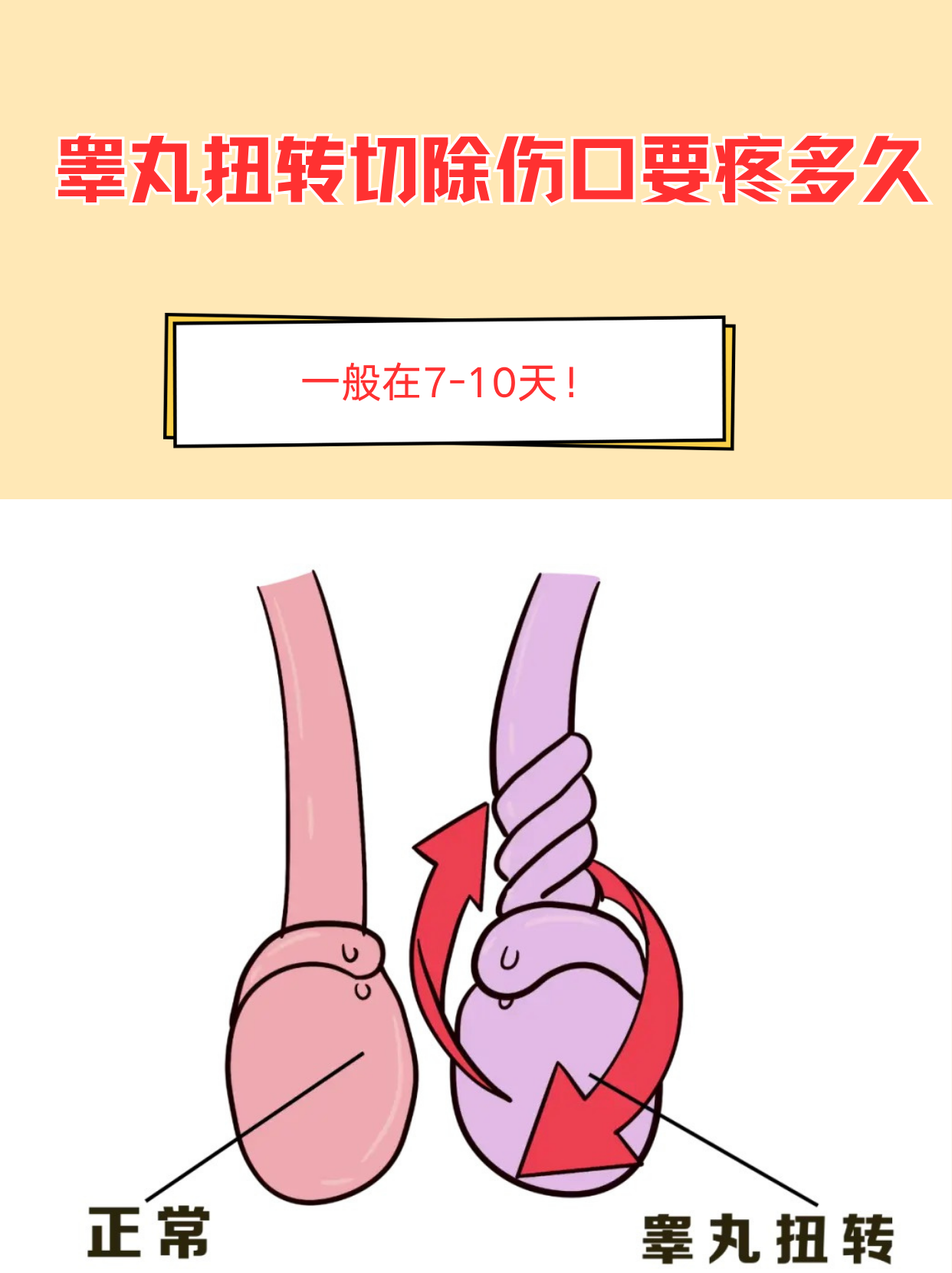 睾丸扭转切除伤口要疼多久