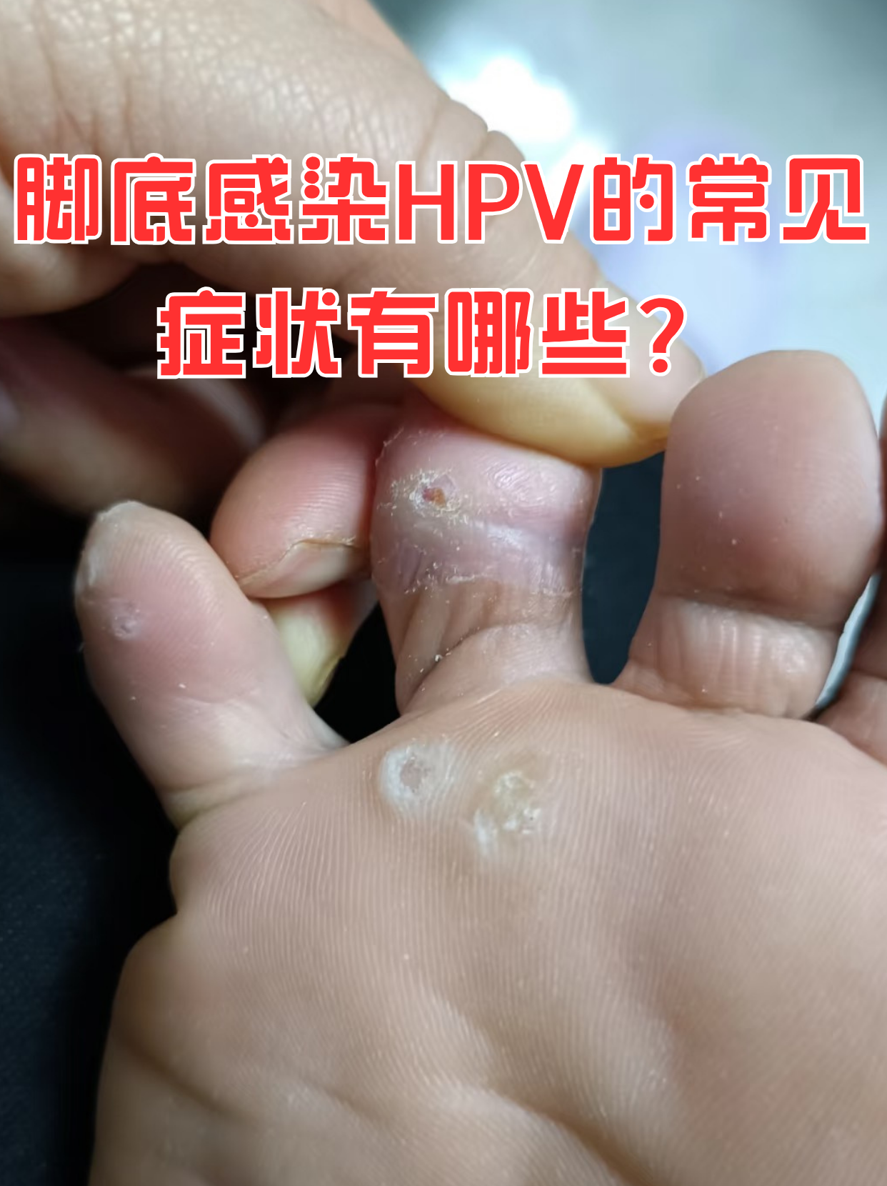  现在流行什么病毒?感染症状是什么?(最近流感病毒最新症状)