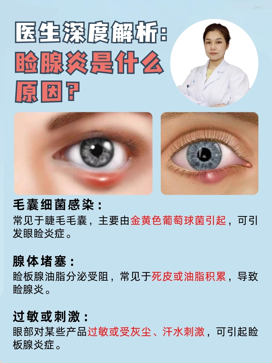 医生深度解析:睑腺炎是什么原因?