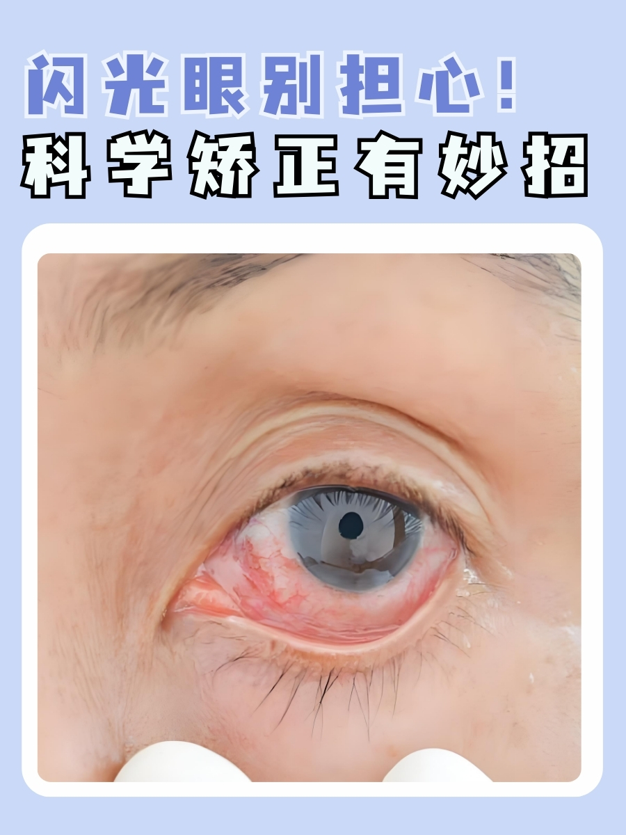 抖音激光眼睛闪=抖音激光眼睛特效