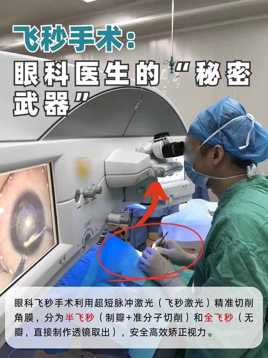 飞秒手术,全称为飞秒激光手术,是一种先进的角膜屈光手术