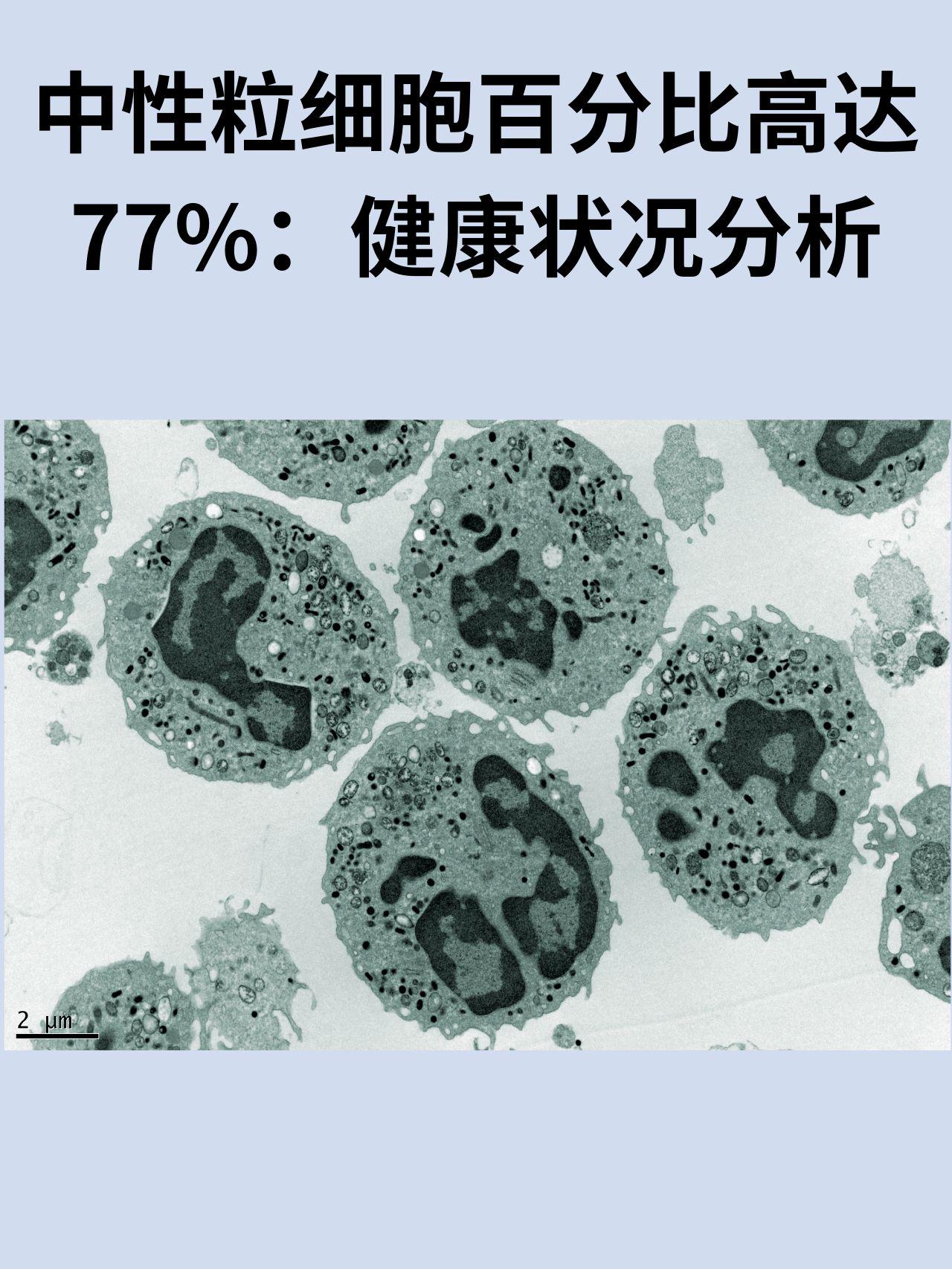 中性粒细胞百分比图片