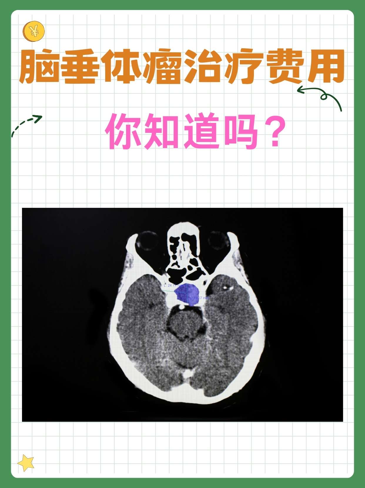 儿童脑垂体大小对照表图片