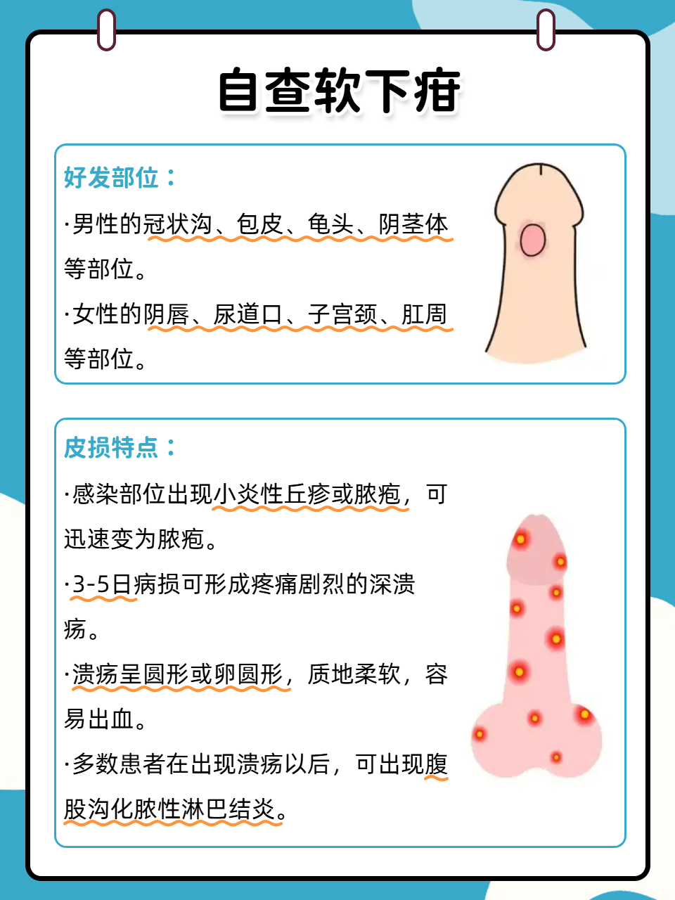 破解疑问  软下疳是一种由杜克雷嗜血杆菌引起的性传播性疾病,主要