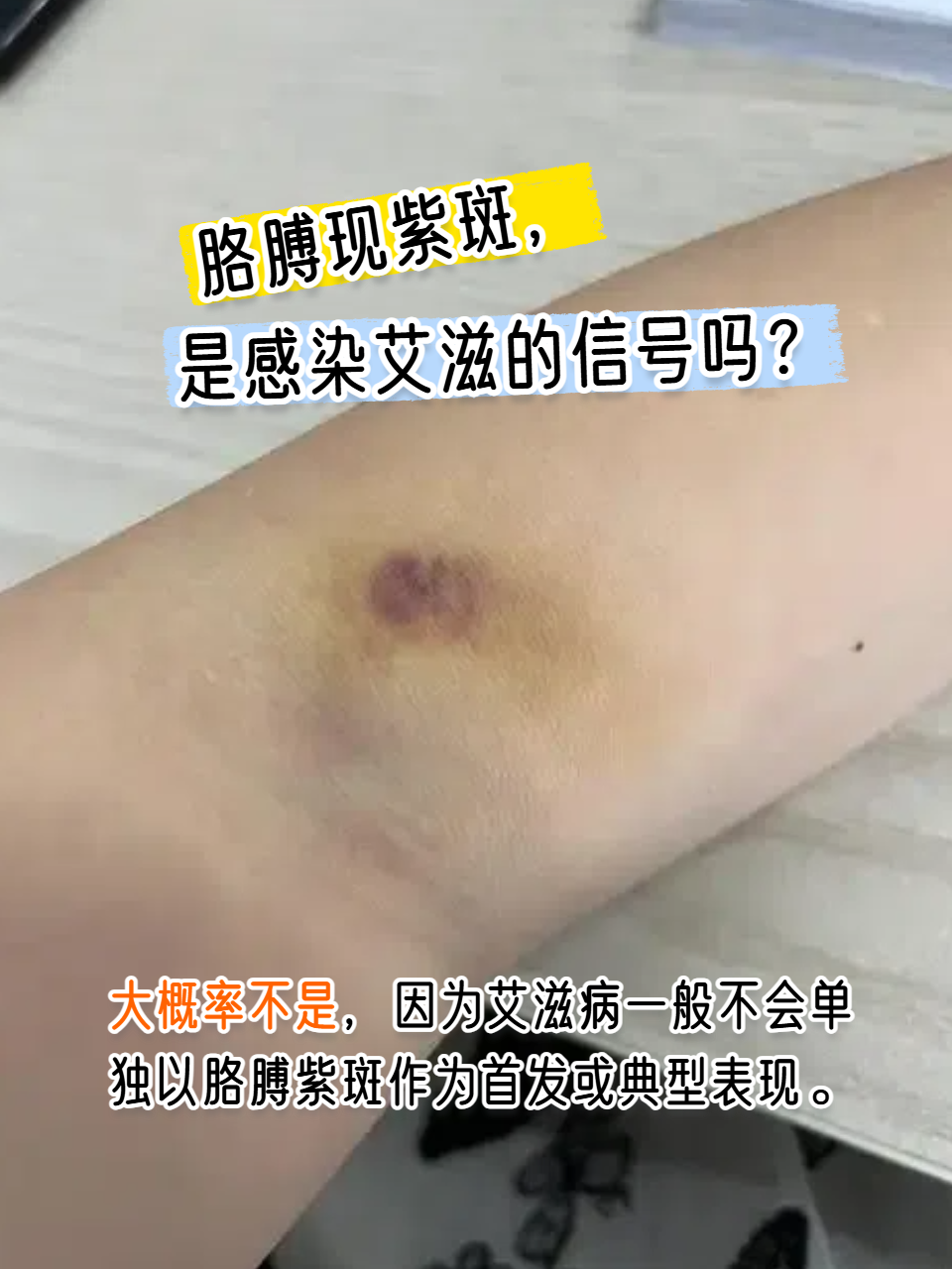 胳膊现紫斑,是感染艾滋的信号吗?