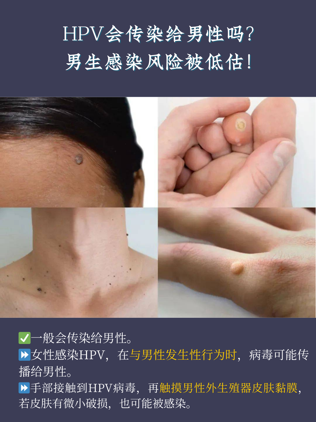 hpv会传染给男性吗?男生感染风险被低估!