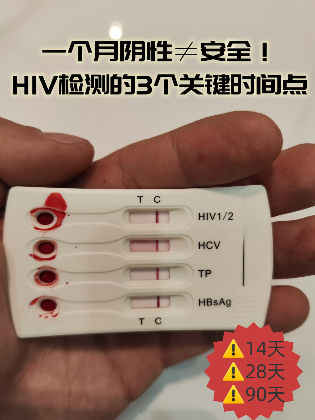 堪滩∠旅嬉桓鲈 hiv艾滋病抗体检测hiv检测艾滋病一个月能检查出来