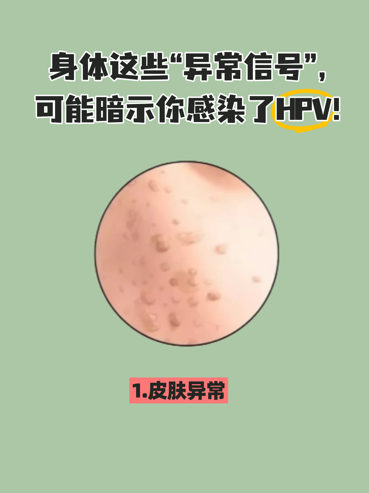  hpv病毒症状图片(hpv病毒症状图片大全)