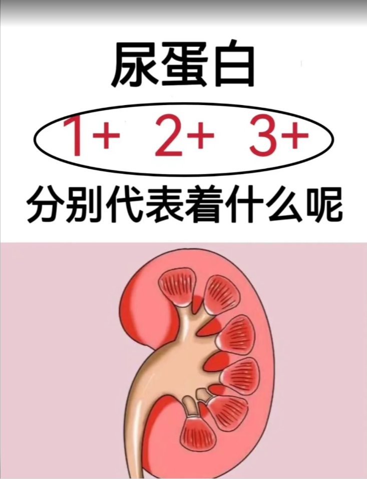 蛋白尿的特征图片