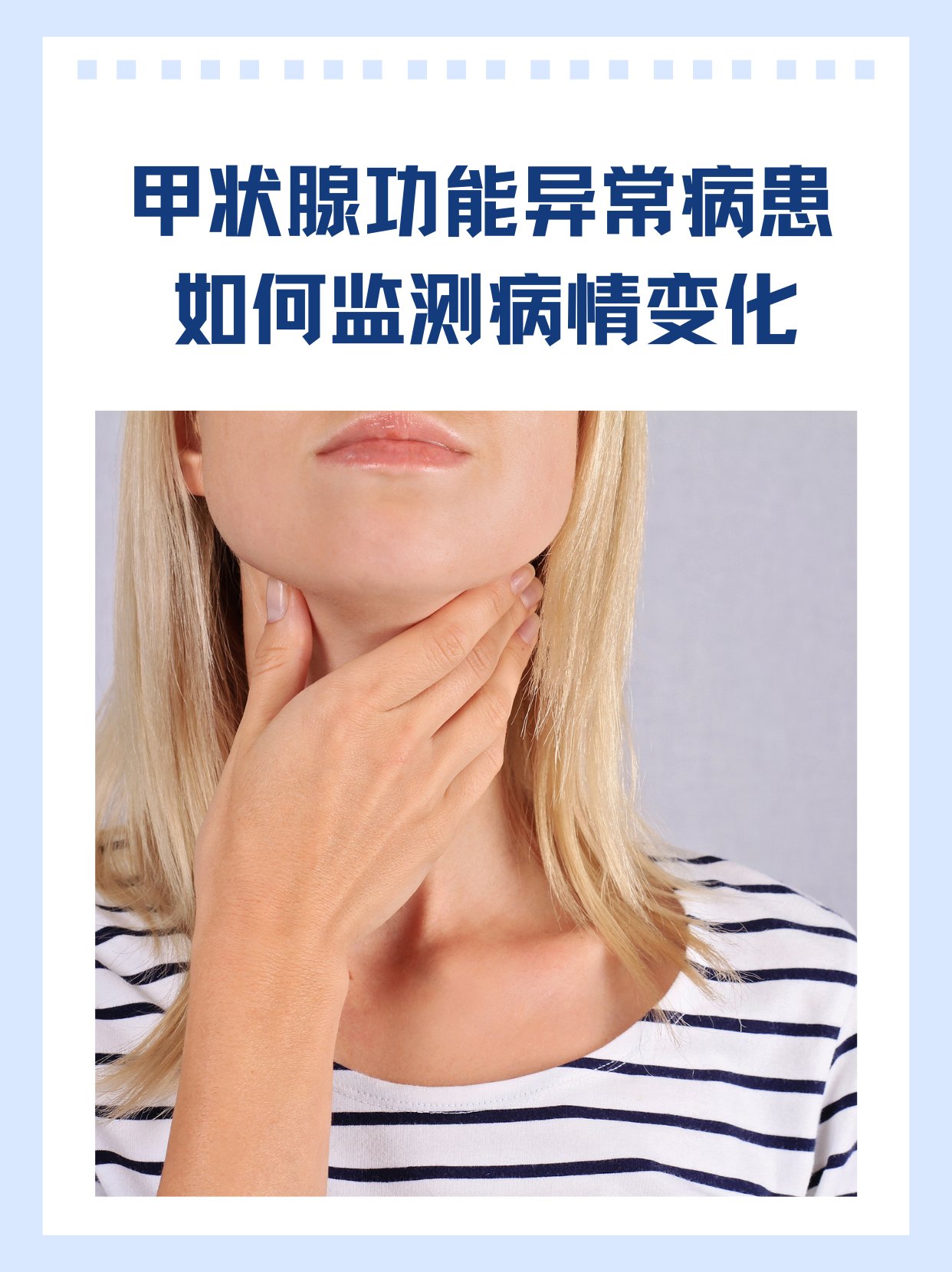 甲状腺功能异常患者如何监测病情变化?