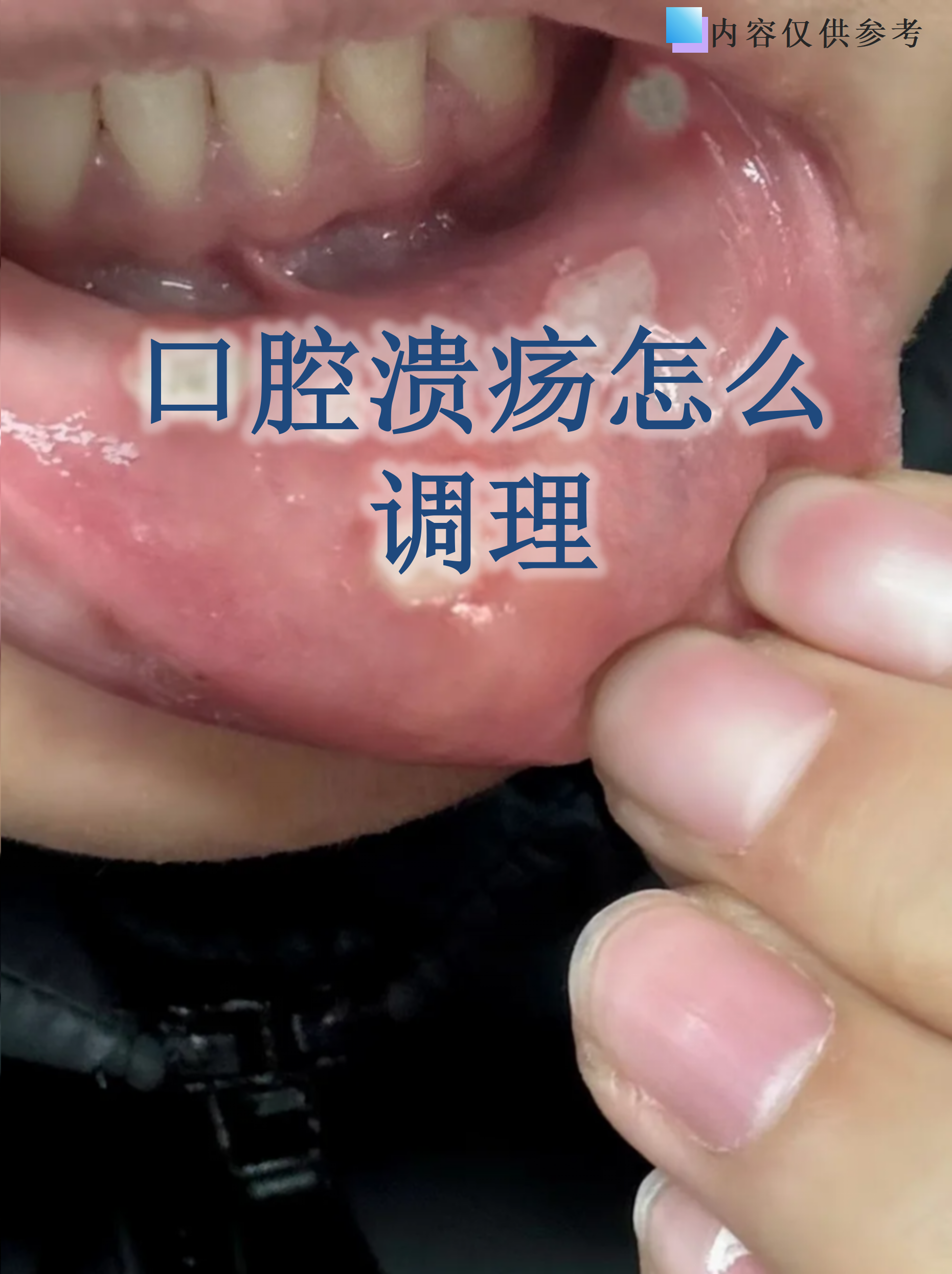 关于北京大学口腔医院代诊挂号服务出院居家护理提醒,科学恢复身体的信息 关于北京大学口腔医院代诊挂号服务出院居家护理提醒,科学恢复身体的信息