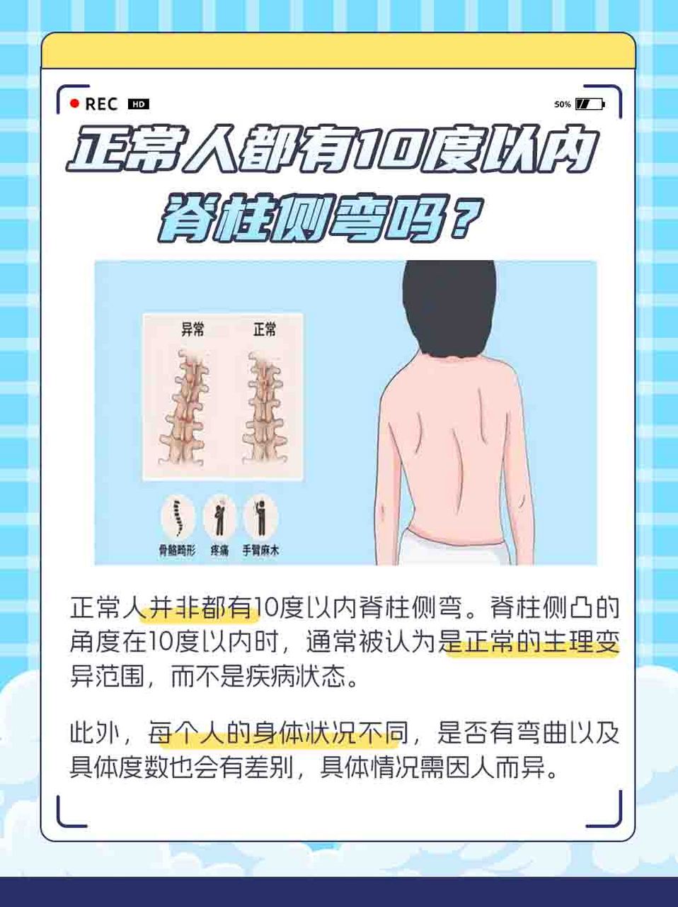 脊柱侧弯怎么看出来图片