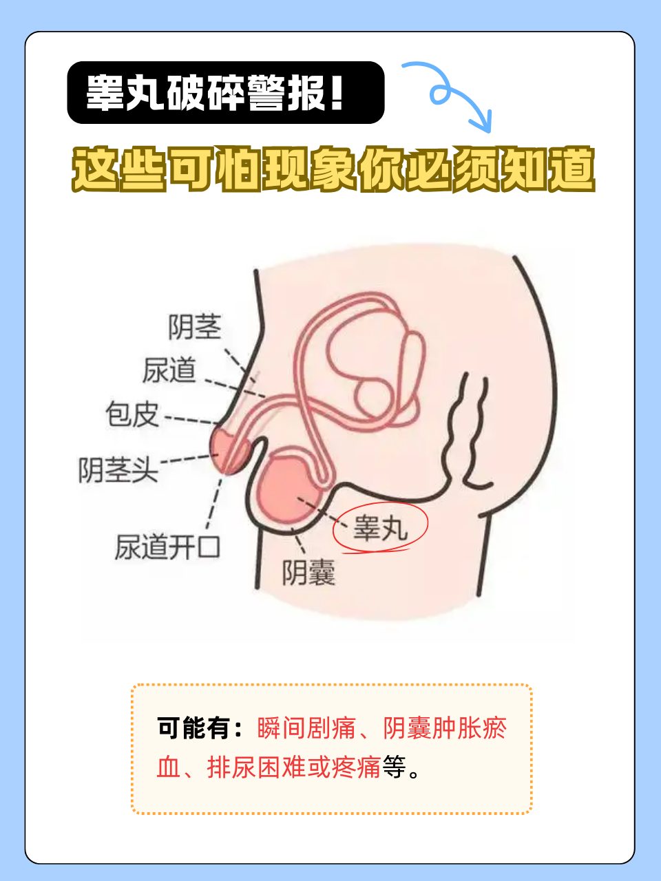 睾丸是男性重要的生殖器官,一旦遭受严重创伤