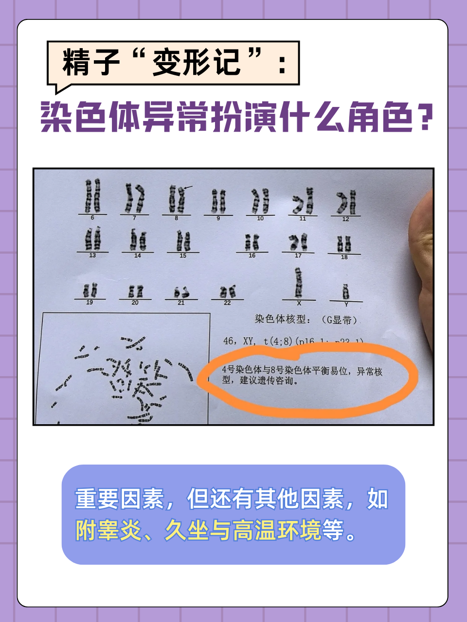 精子"变形记":染色体异常扮演什么角色?