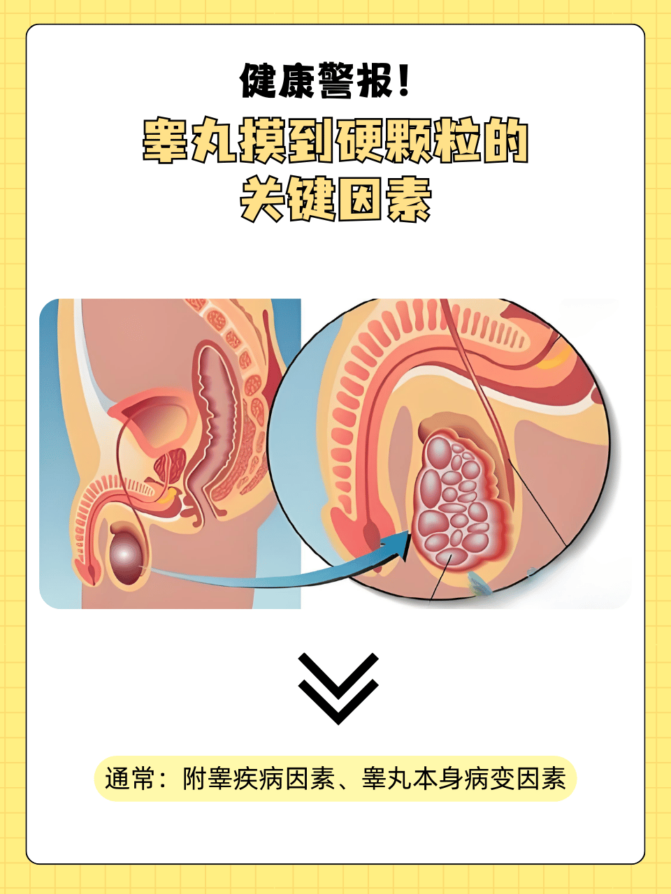 睾丸为什么变硬了为什么在线 睾丸为什么变硬了为什么在线