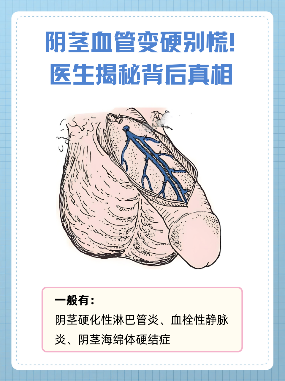 阴茎为什么会变黑 阴茎为什么会变黑