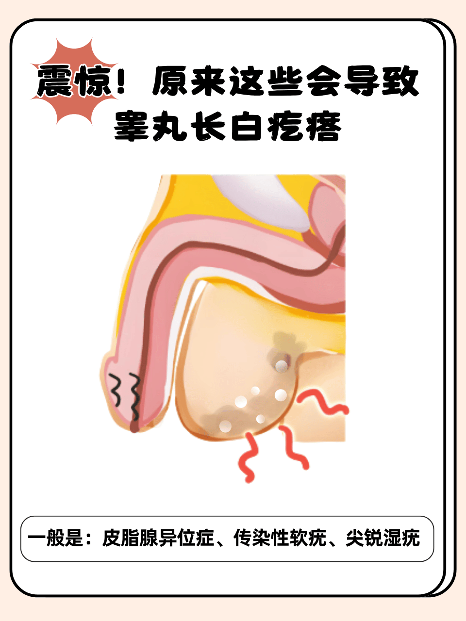 这些白色疙瘩成因多样,从正常生理现象到疾病因素都有可能