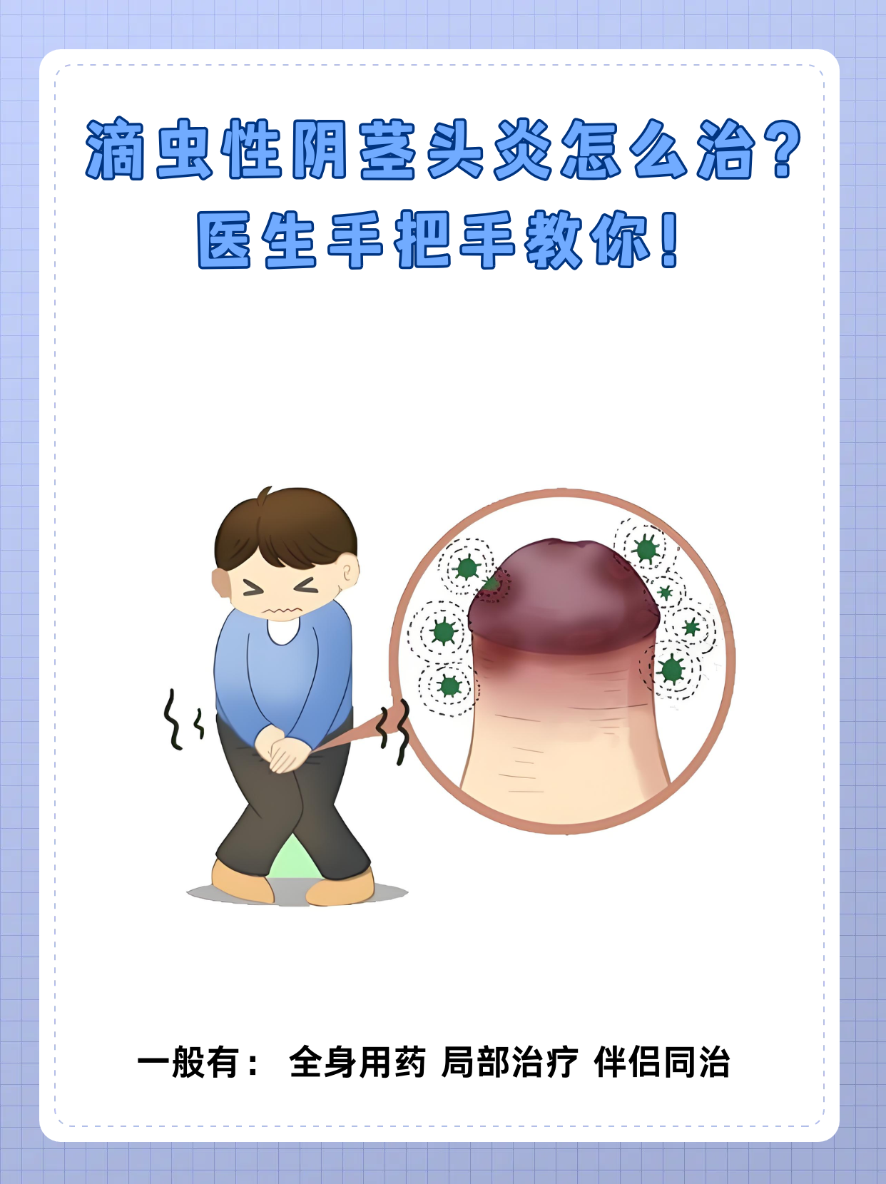 滴虫性阴茎头炎的发病原因 病原体感染:阴道