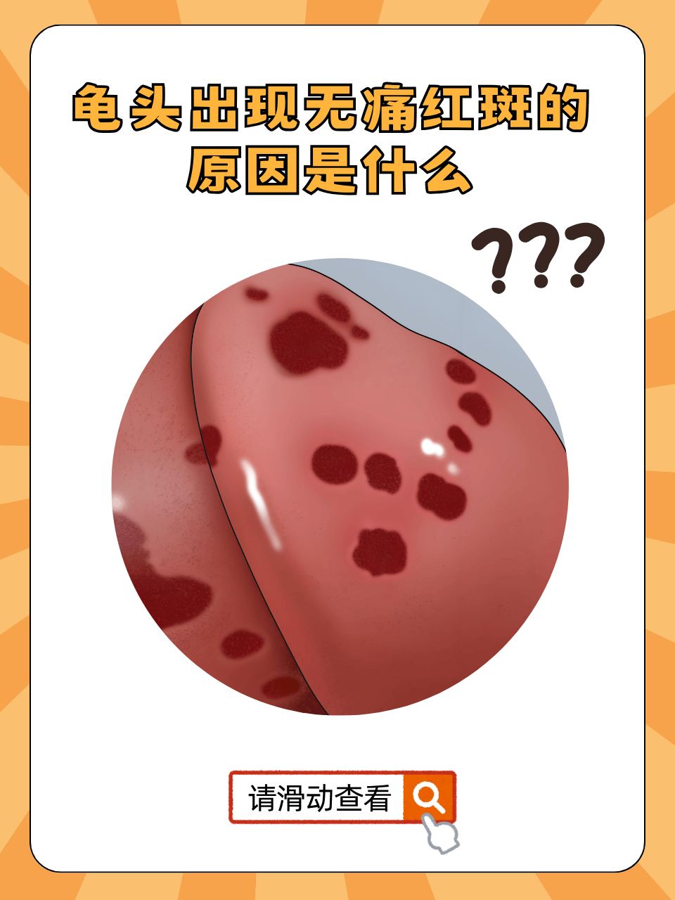 龟头出现无痛红斑的原因是什么
