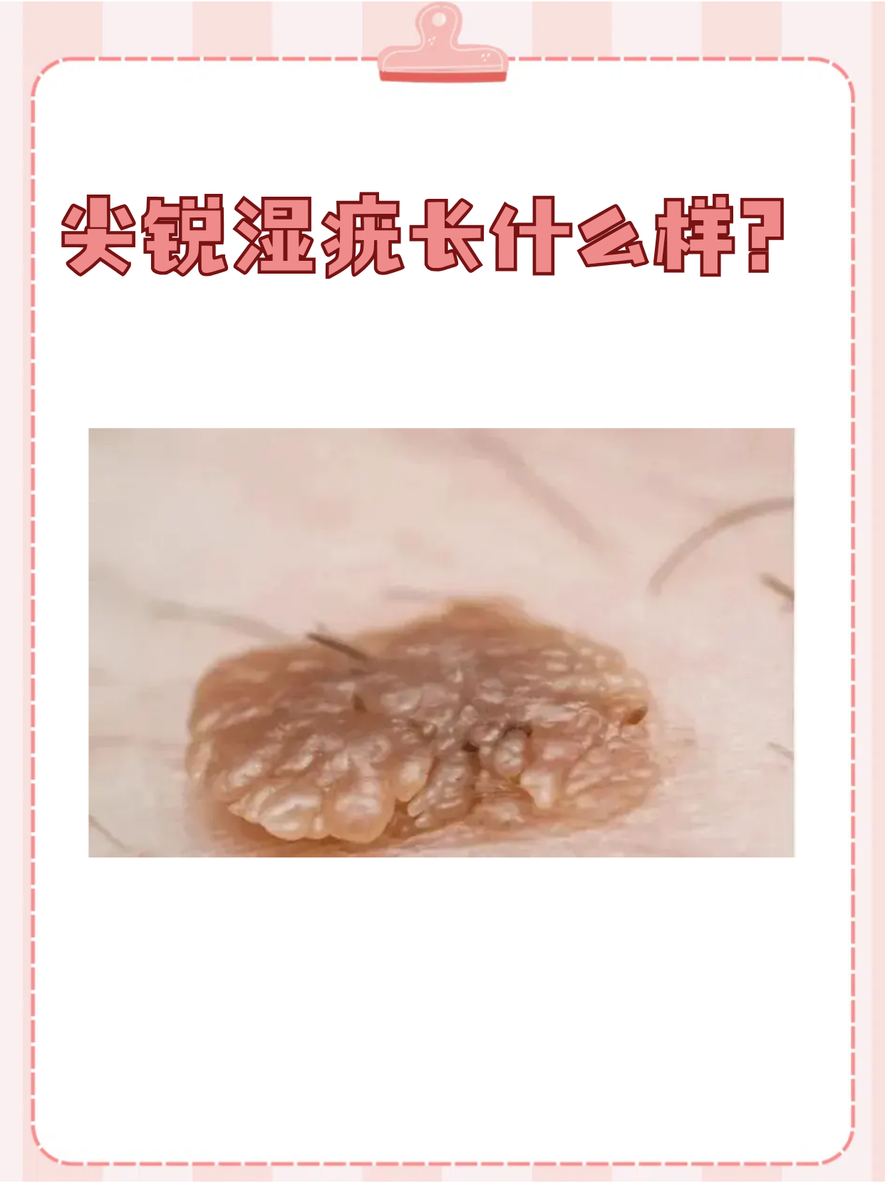 夏天穿得清凉时,皮肤问题更容易被关注