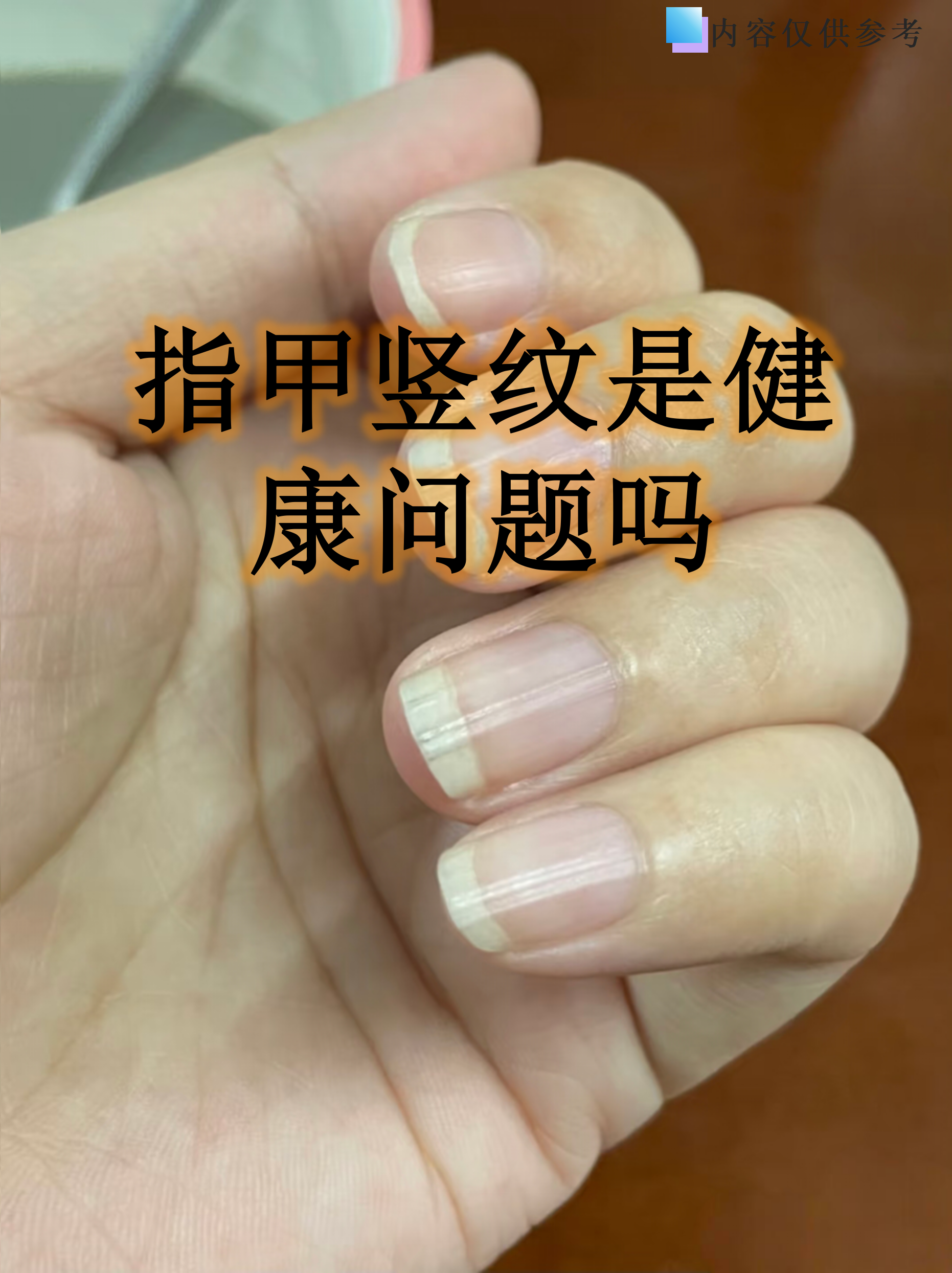 指甲上出现竖纹其实很常见,许多人第一反应是