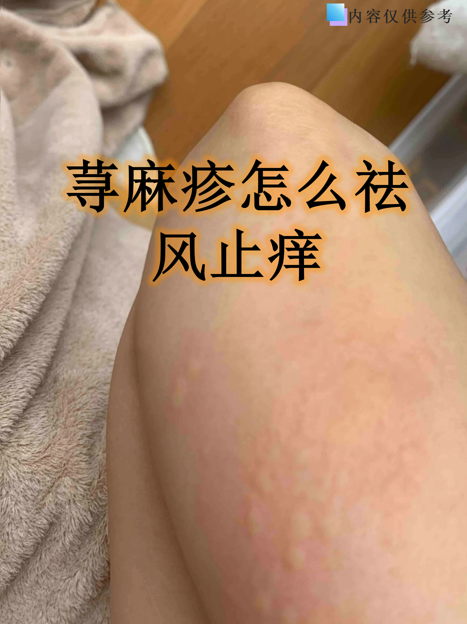 荨麻疹发作时皮肤瘙痒难忍,像被无数小蚂蚁啃咬