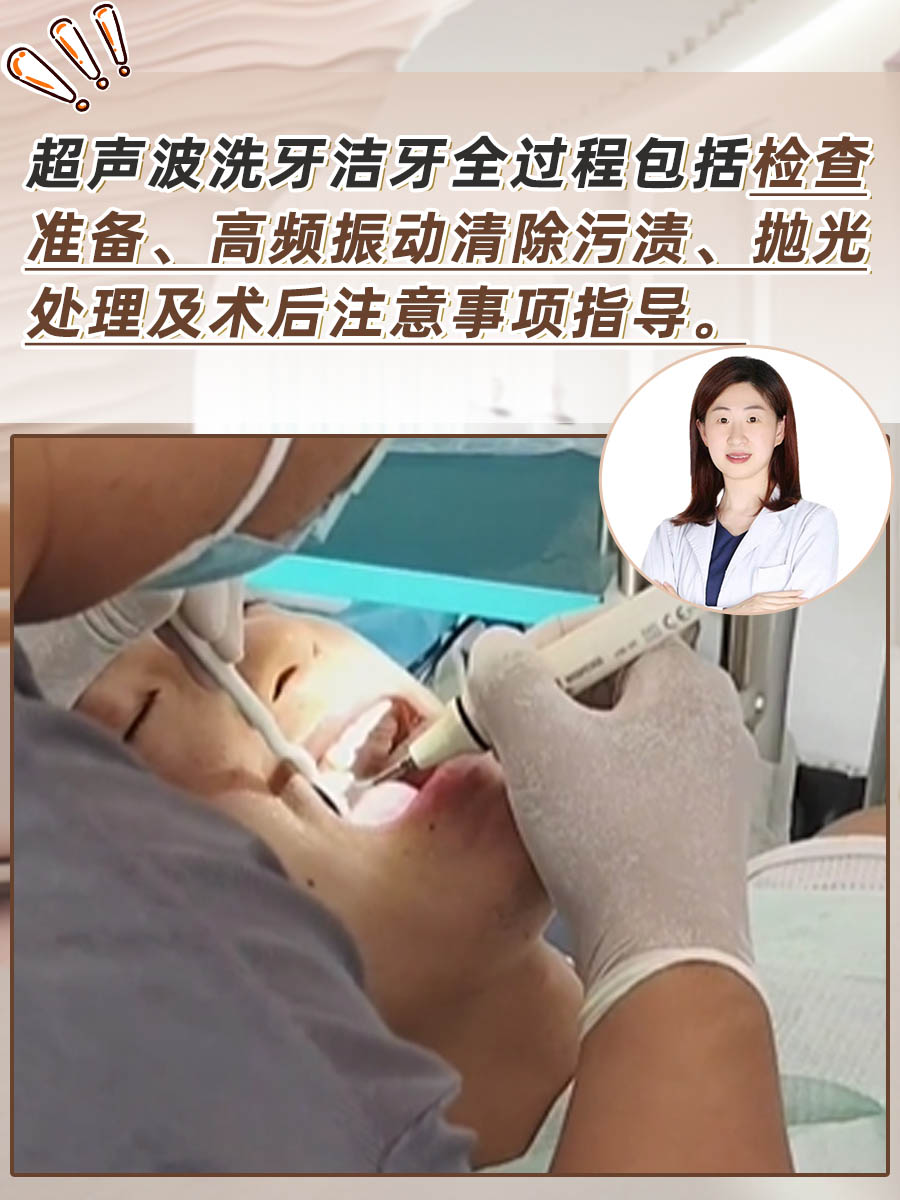 超声波洗牙洁牙全过程分享!