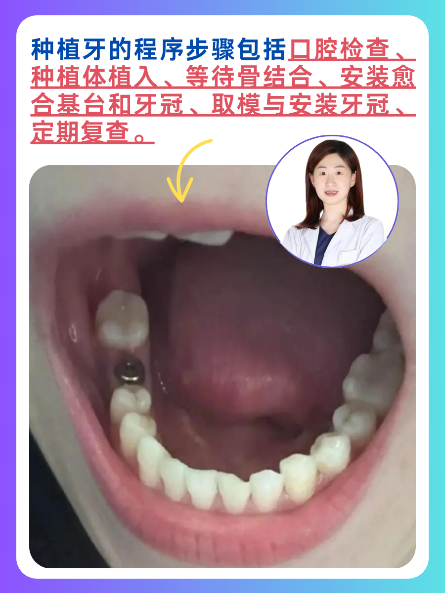 摘牙冠的过程图解图片