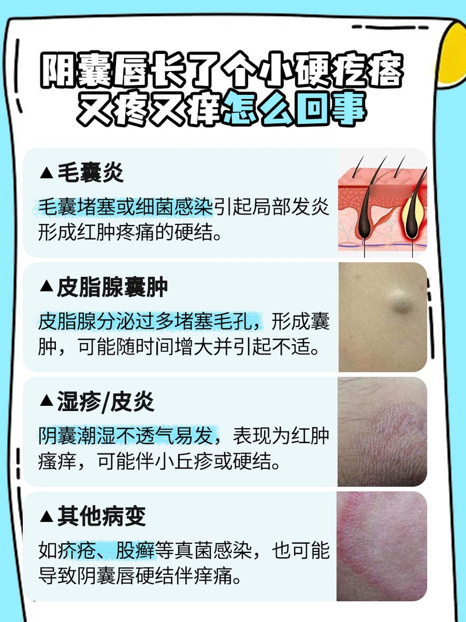 揭秘  😳在探讨男性私密健康时,阴囊唇上偶尔出现的小硬疙瘩往往会