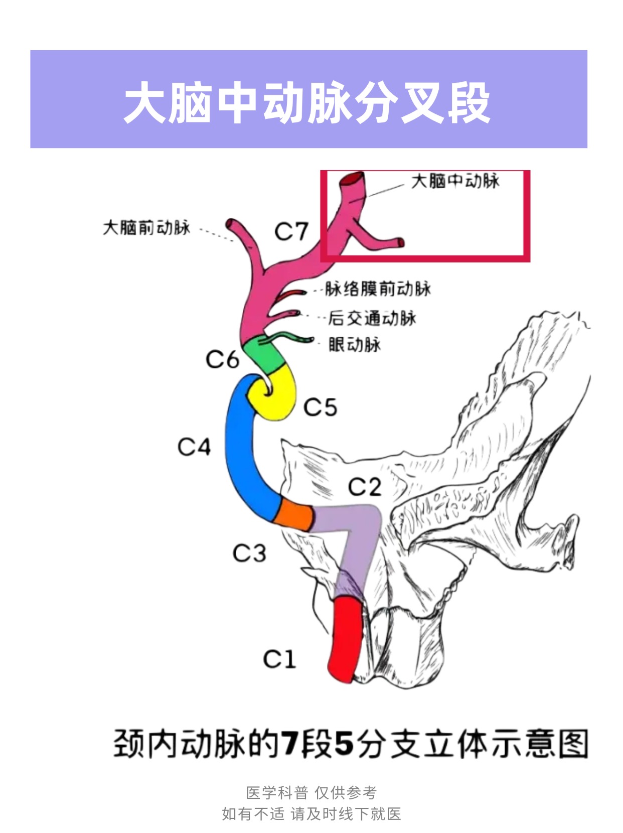 脑动脉在什么位置图片图片