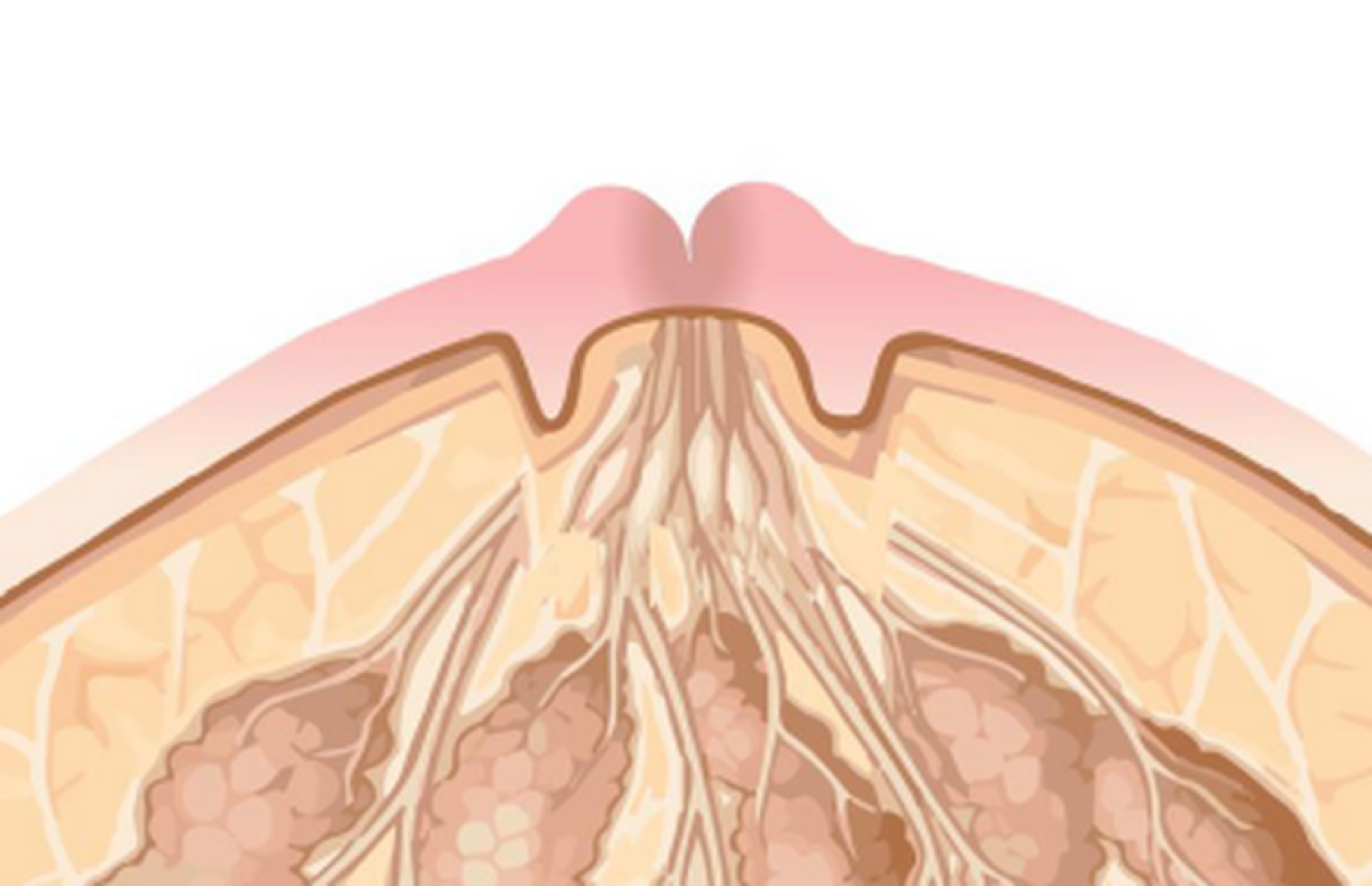你可能是浆细胞性乳腺炎的"高危人群"  在女性健康领域,乳头内陷这一