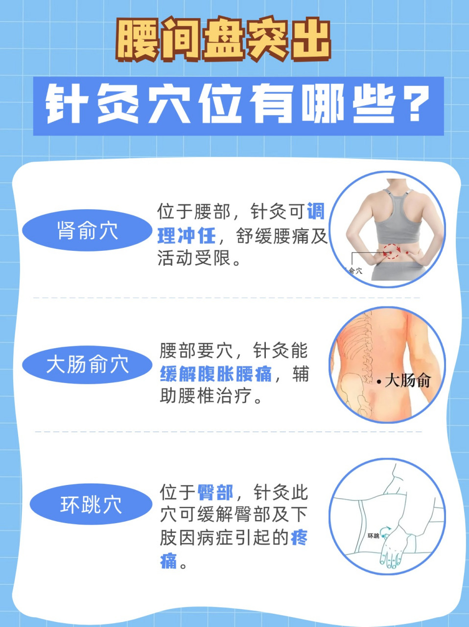 肾关准确位置图和金针图片