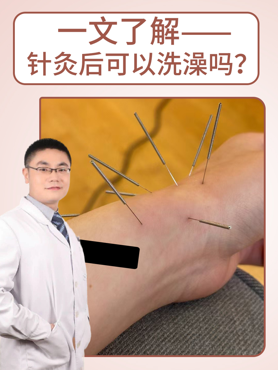 针灸是一项中医临床治疗性的操作,而针灸后的注意事项也是比较重要