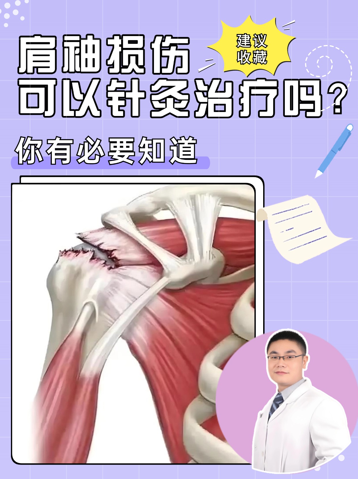 冈上肌肌腱炎治疗图片