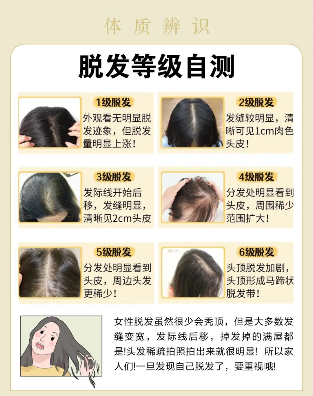 掉髮原因
