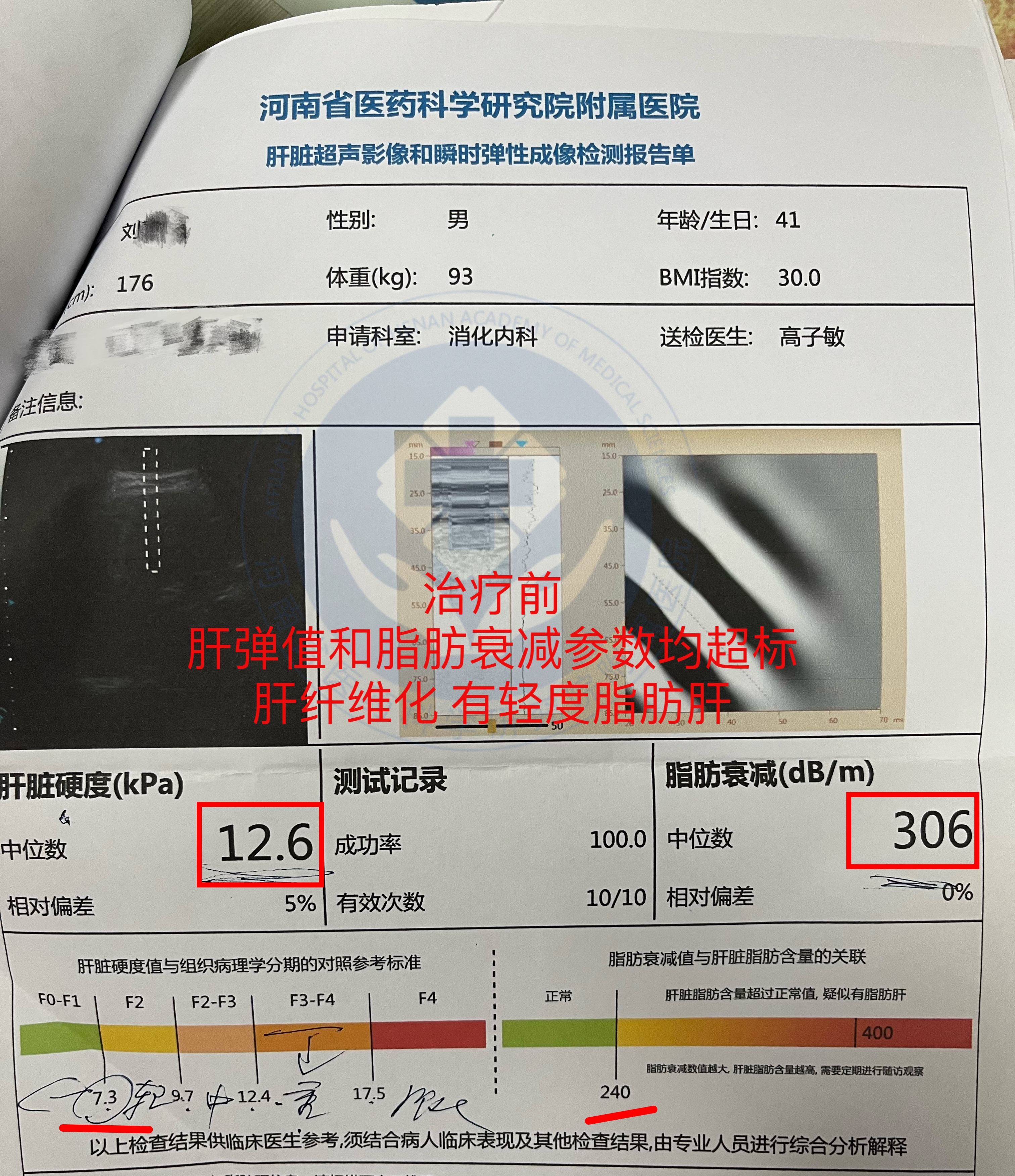 肝癌化验单结果图片图片