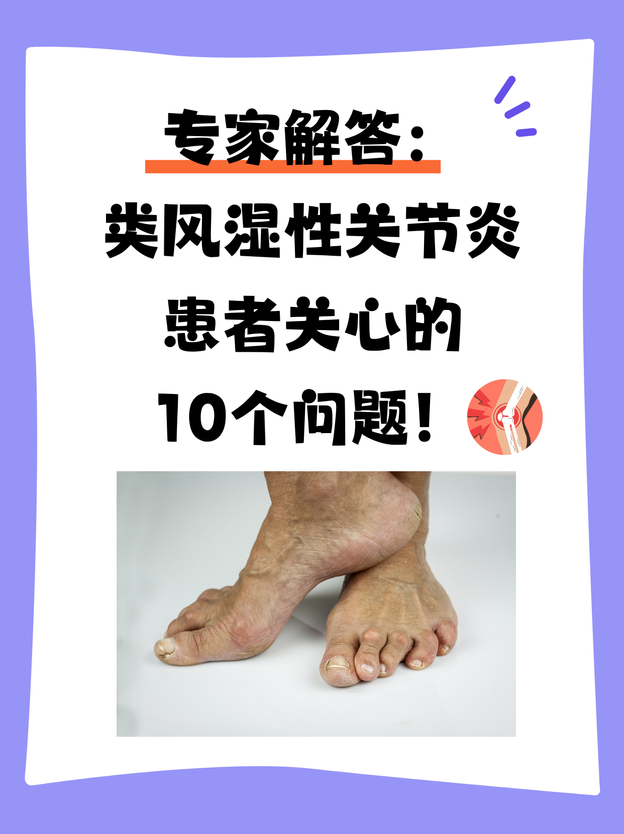 为什么会得类风湿关节炎