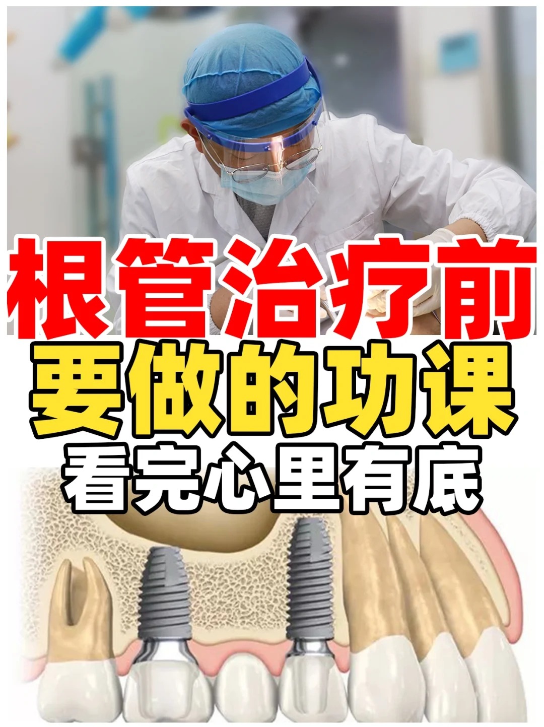 建根图片和用法图片