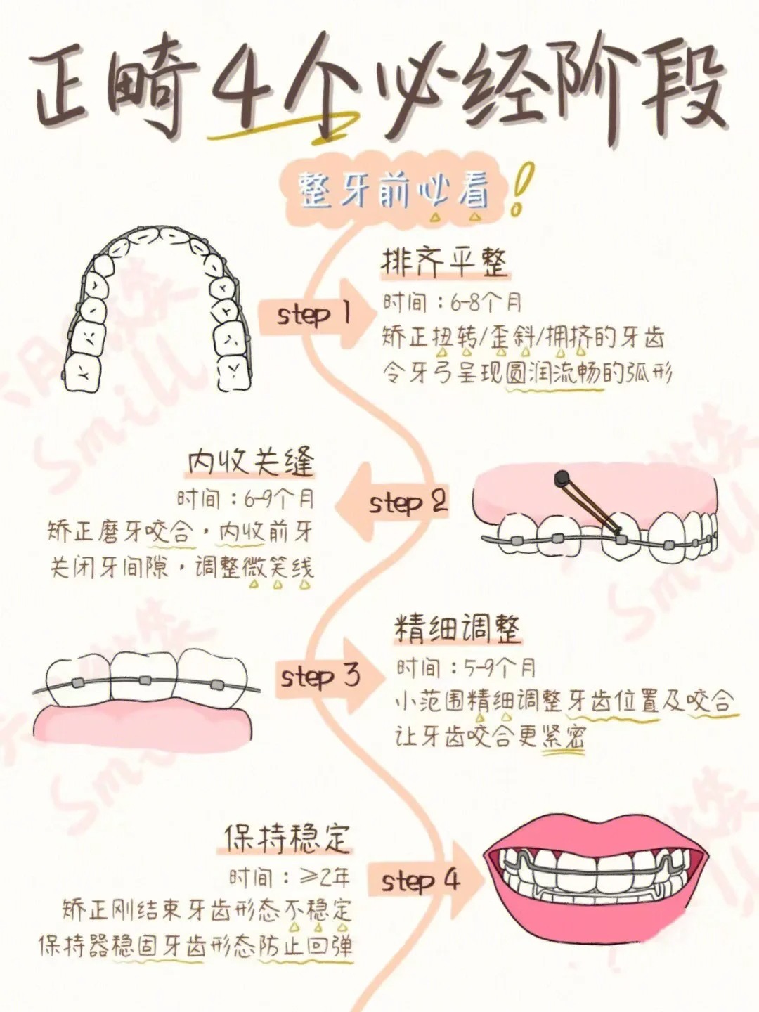 平整牙弓,调整牙齿上下,左右位置关系