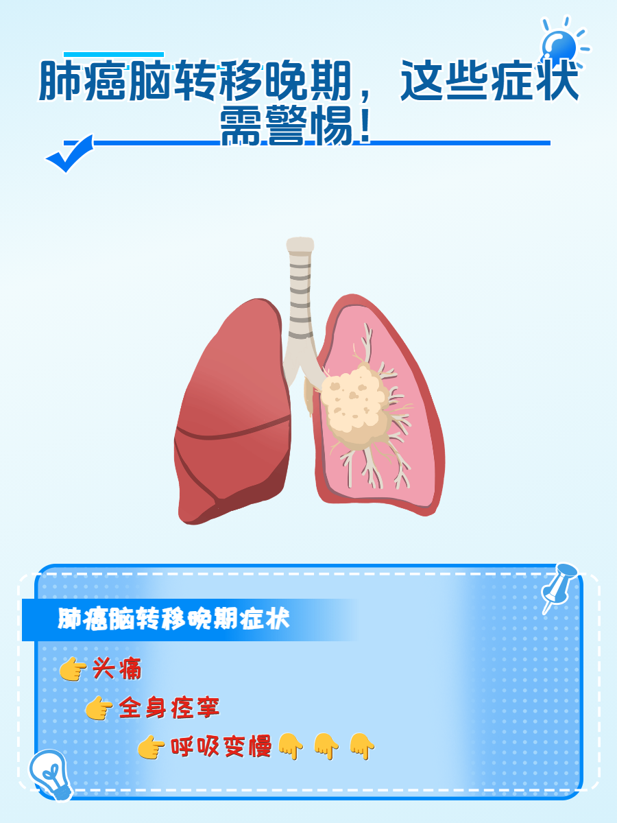 肺癌脑转移晚期,这些症状需警惕!